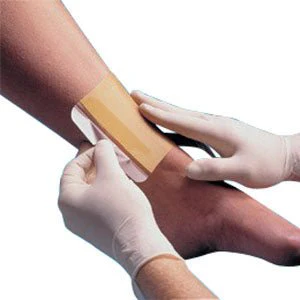 EA/1 - Replicare Hydrocolloid Dressing 8" x 8"