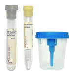 CA/50 - BD Vacutainer Urine Collection Kit with Screw-Cap Cup