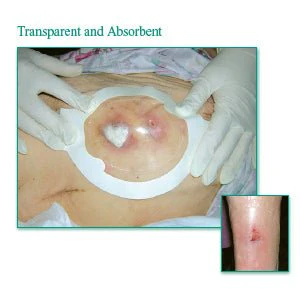 EA/1 - Tegaderm Clear Absorbent Acrylic Dressing 3" x 3-3/4" Oval